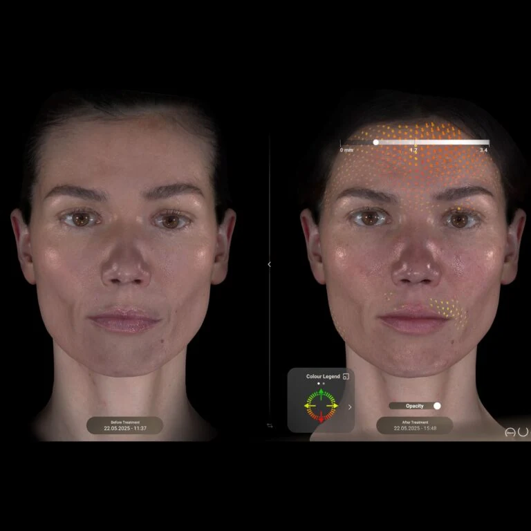Аппарат для анализа кожи AURA 3D в клинике alestetics® в Цюрихе